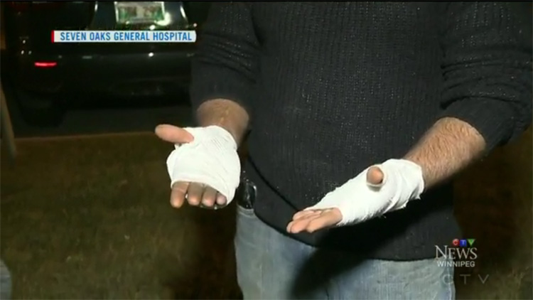 galaxy-s7-canadian-explosion-4